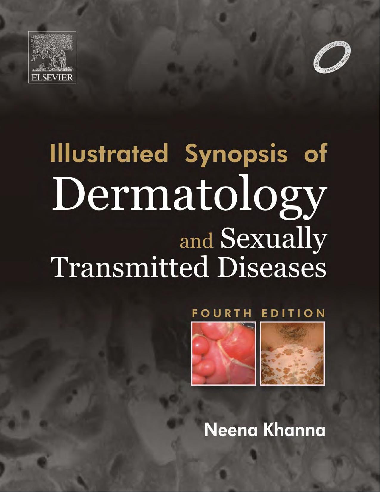 Illustrated Synopsis Of Dermatology and Sexually Transmitted Diseases by Neena Khanna