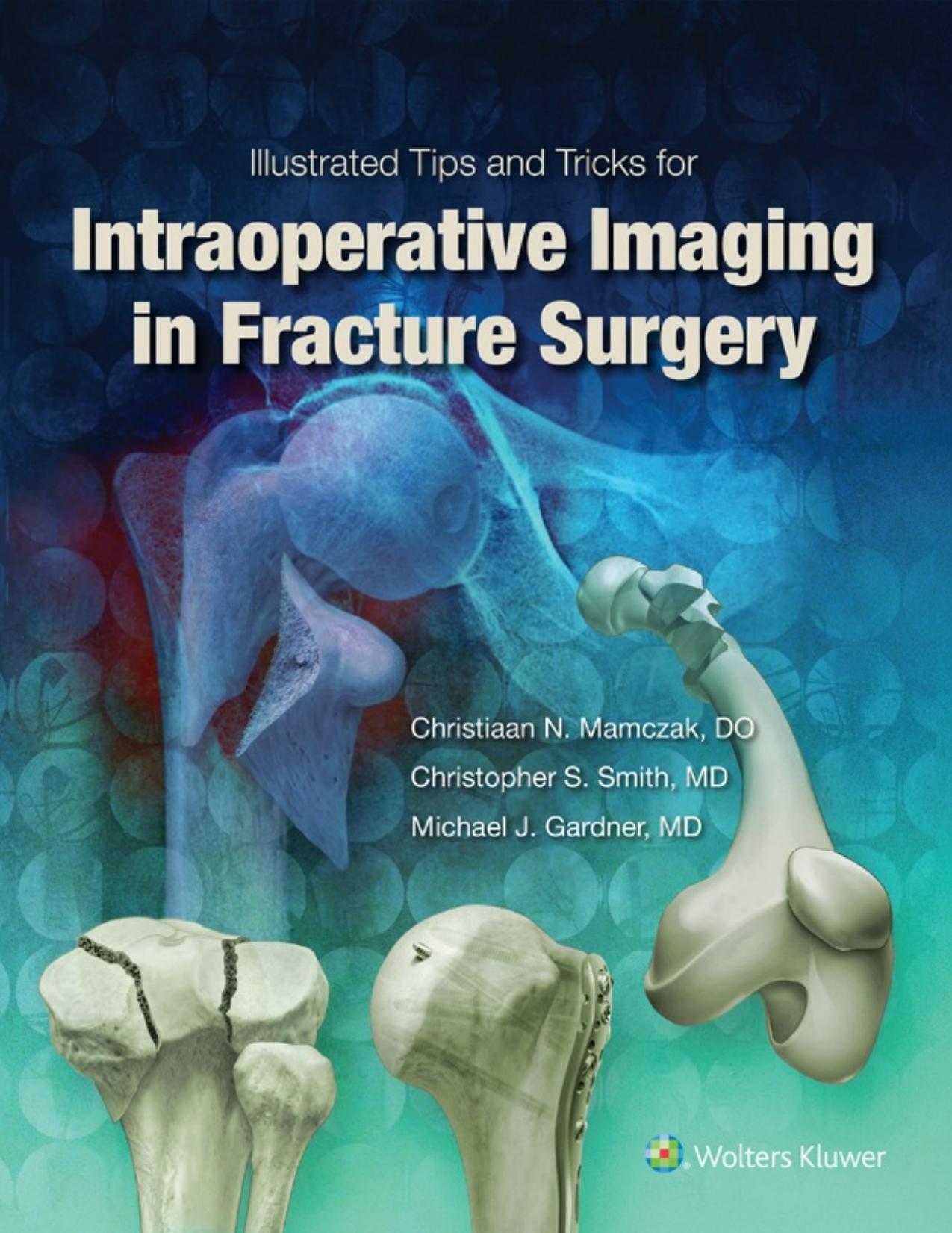 Illustrated Tips and Tricks for Intraoperative Imaging in Fracture Surgery by Unknow
