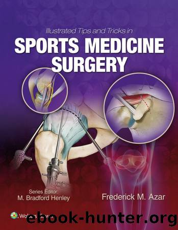 Illustrated Tips and Tricks in Sports Medicine Surgery by Frederick Azar;