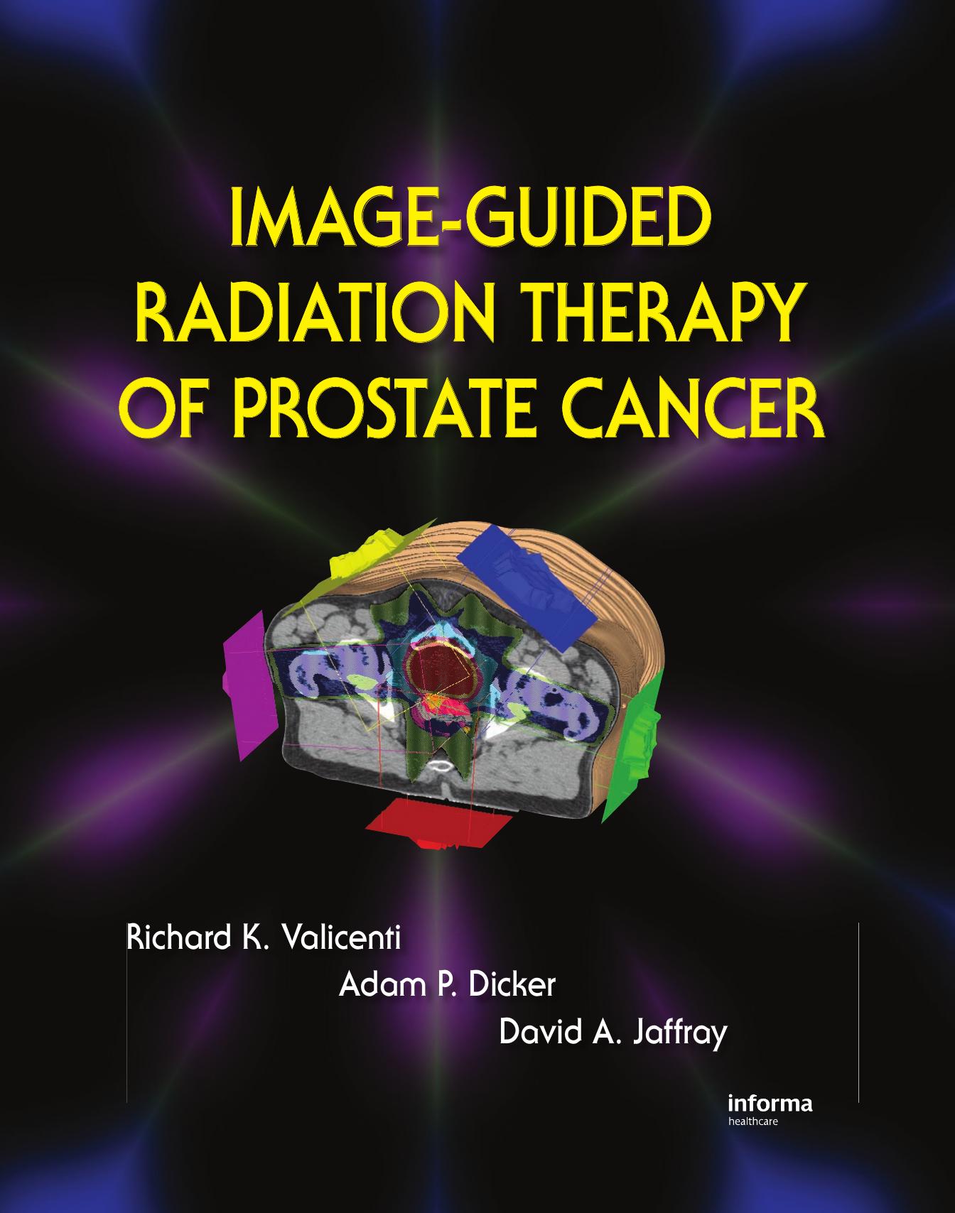Image-Guided Radiation Therapy of Prostate Cancer (Repost) by Richard K. Valicenti Adam P. Dicker David A. Jaffray