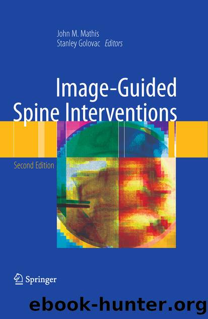 Image-Guided Spine Interventions by John M. Mathis & Stanley Golovac