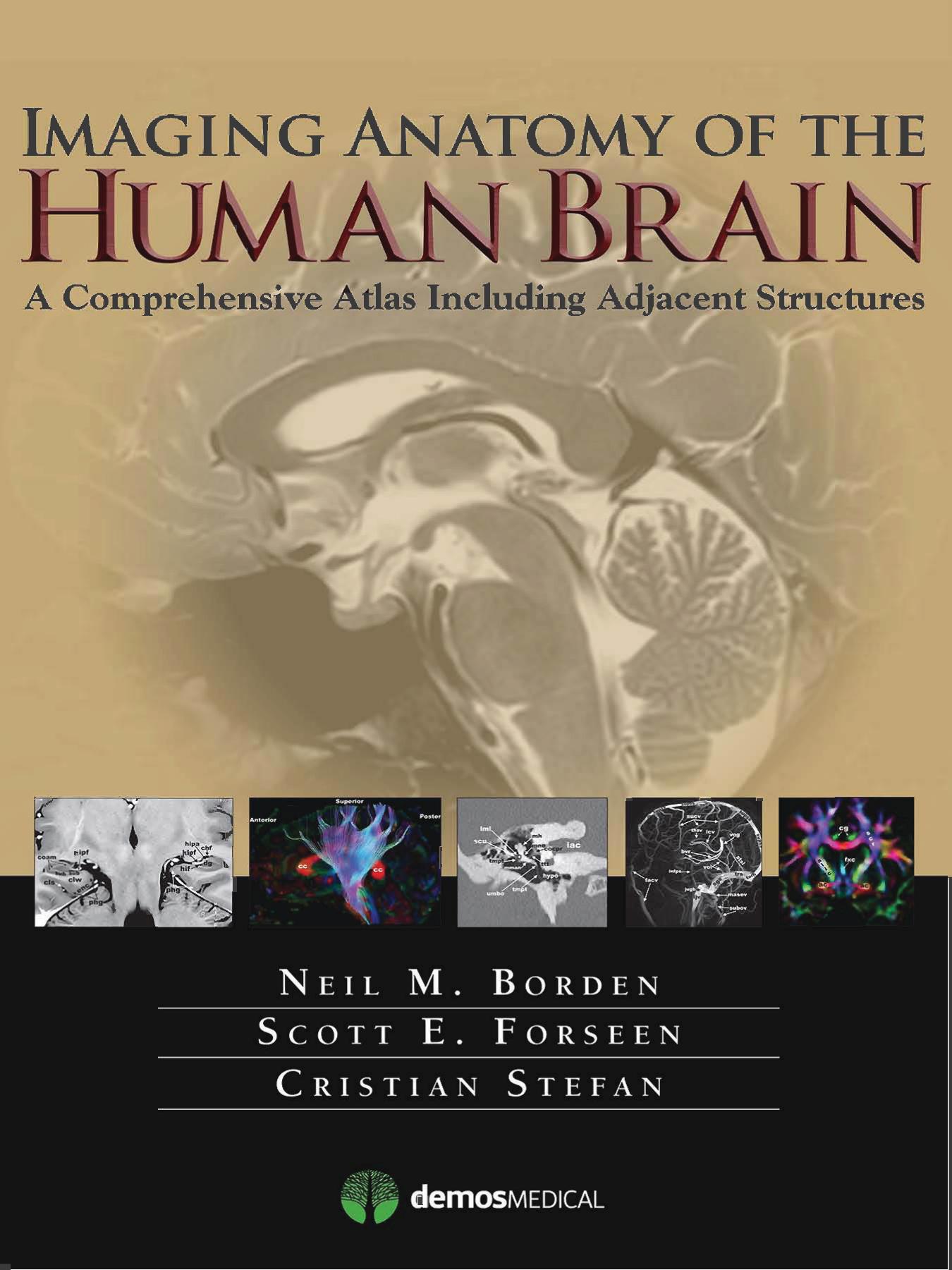 Imaging Anatomy of the Human Brain: A Comprehensive Atlas Including Adjacent Structures by Neil M. Borden Scott E. Forseen Cristian Stefan