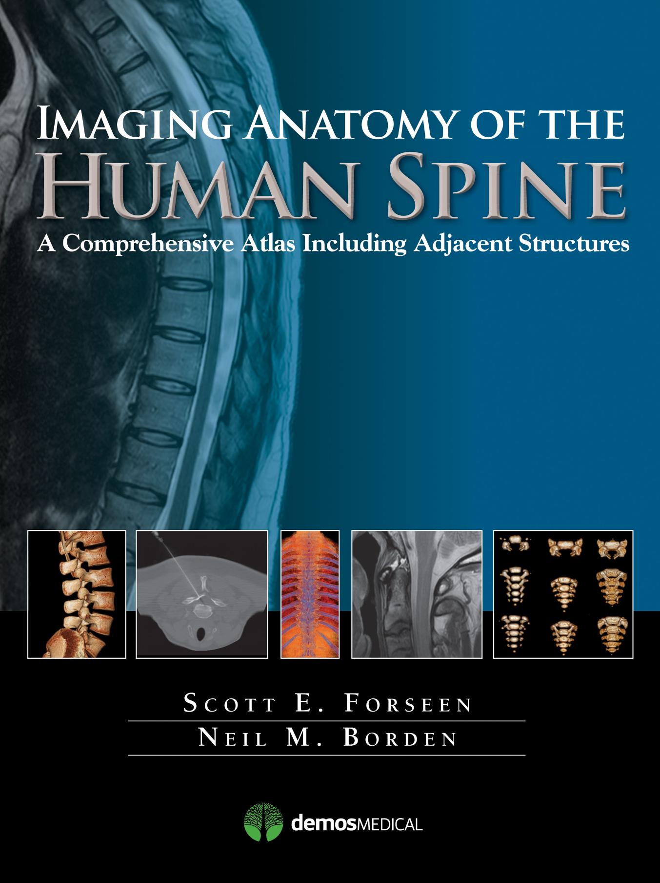 Imaging Anatomy of the Human Spine: A Comprehensive Atlas Including Adjacent Structures by Scott E. Forseen Neil M. Borden