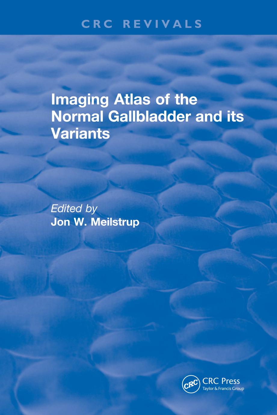 Imaging Atlas of the Normal Gallbladder and Its Variants by J.W. MEILSTRUP