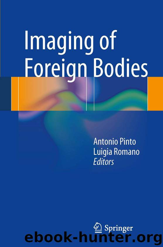 Imaging of Foreign Bodies by Antonio Pinto & Luigia Romano