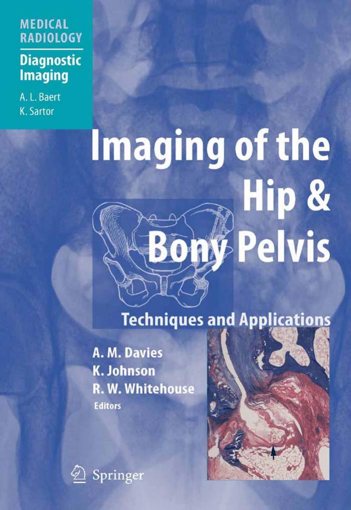 Imaging of the Hip & Bony Pelvis: Techniques and Applications by A.M. Davies K. Johnson and R.W. Whitehouse