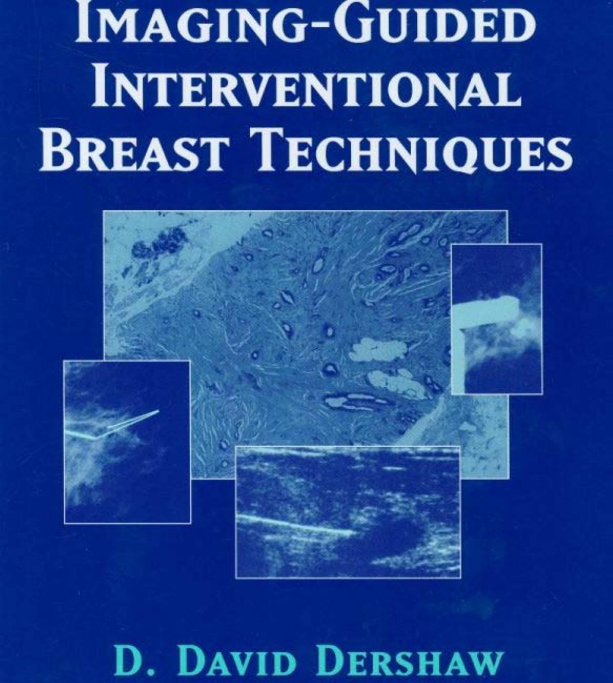 Imaging-Guided Interventional Breast Techniques by Luc J. Jordaens Dominic A.M.J. Theuns