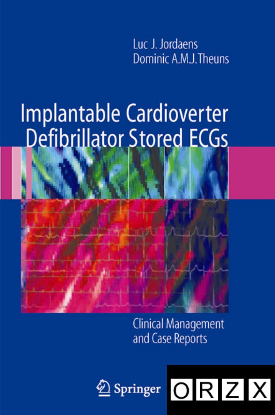 Implantable Cardioverter Defibrillator Stored ECGs by Luc J. Jordaens Dominic A.M.J. Theuns