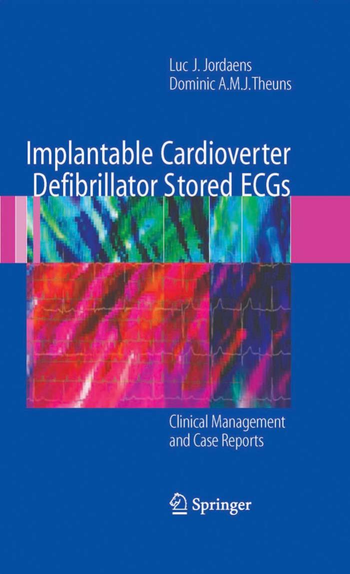Implantable Cardioverter Defibrillator Stored ECGs: Clinical Management and Case Reports by Luc J. Jordaens Dominic A.M.J. Theuns