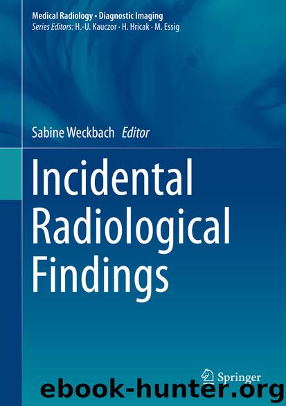 Incidental Radiological Findings by Sabine Weckbach