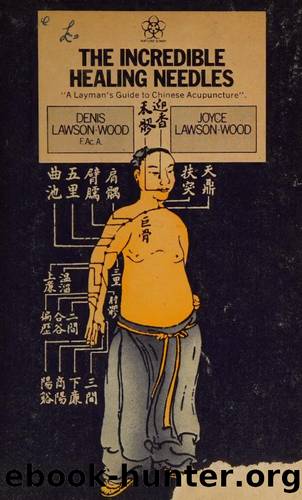 Incredible Healing Needles: Layman's Guide to Chinese Acupuncture by D && J Lawson-Wood