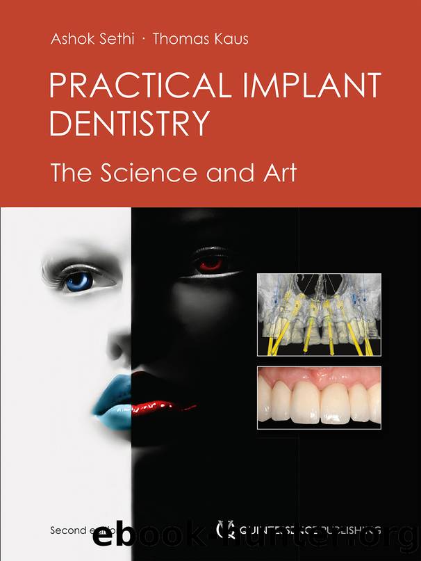 Indirect Restorations by Bartlett David Ricketts David