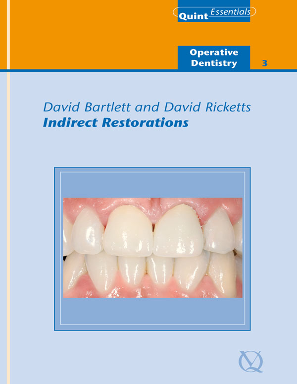 Indirect Restorations by David Bartlett / David Ricketts