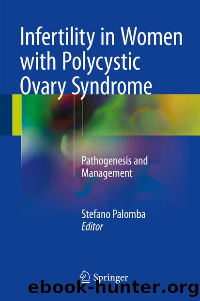 Infertility in Women with Polycystic Ovary Syndrome by Stefano Palomba