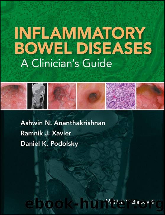 Inflammatory Bowel Diseases: A Clinicianâs Guide by Ashwin N. Ananthakrishnan Ramnik J. Xavier and Daniel K. Podolsky