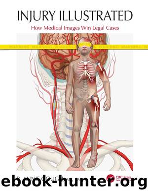 Injury Illustrated: How Medical Images Win Legal Cases by R. Annie Gough