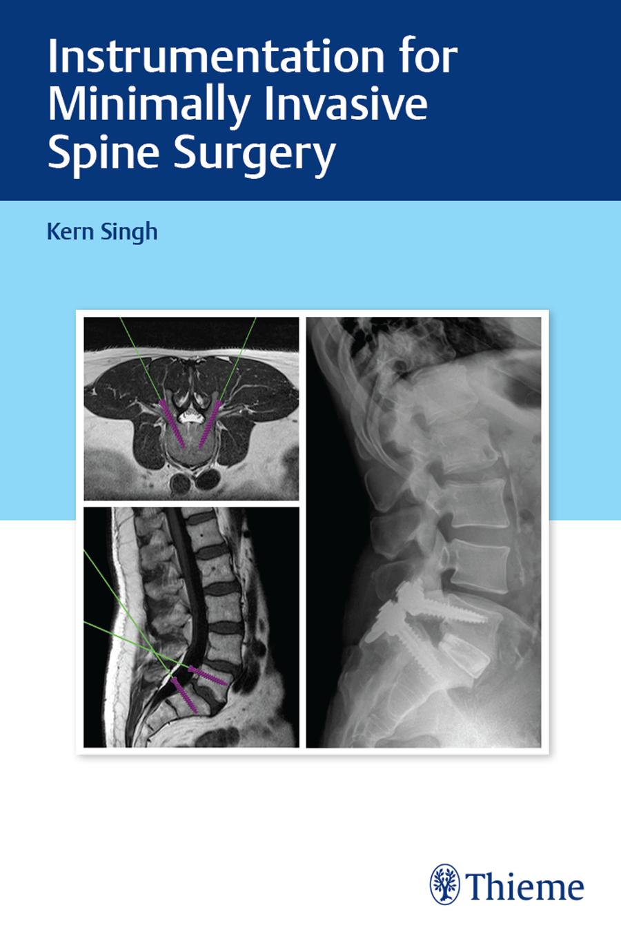 Instrumentation for Minimally Invasive Spine Surgery by Kern Singh