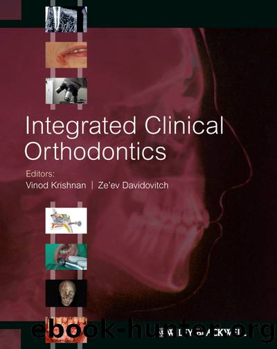 Integrated Clinical Orthodontics by Davidovitch Ze & #39;ev Krishnan Vinod & Ze'ev Davidovitch
