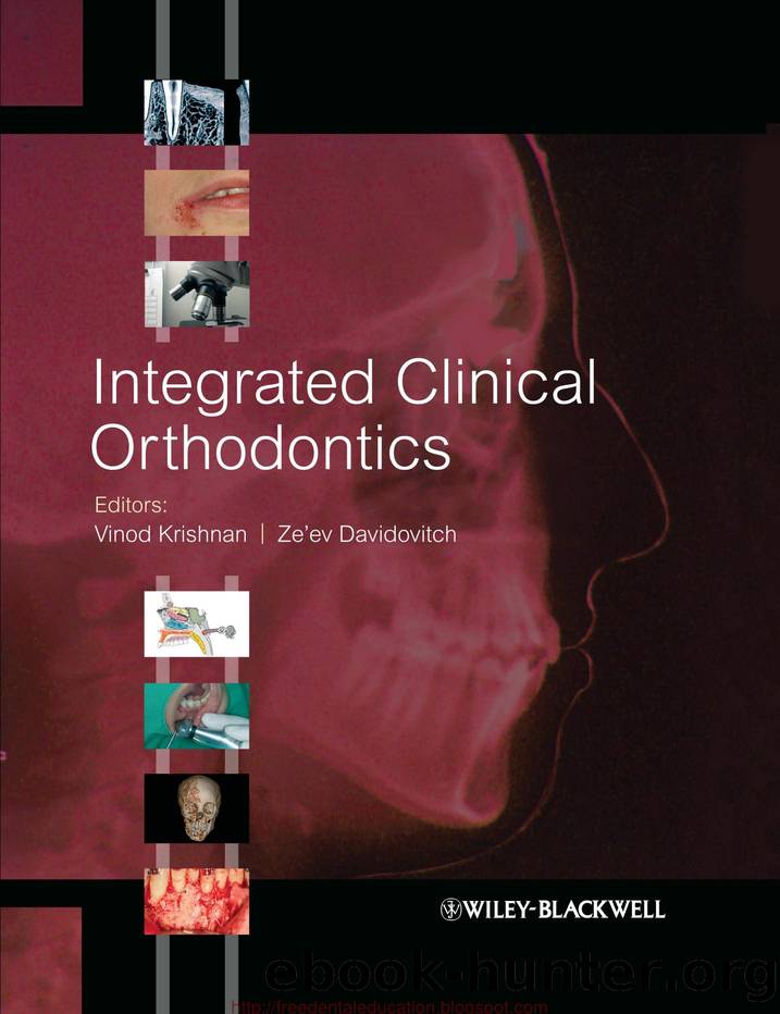 Integrated Clinical Orthodontics by Vinod Krishnan & Ze’ev Davidovitch