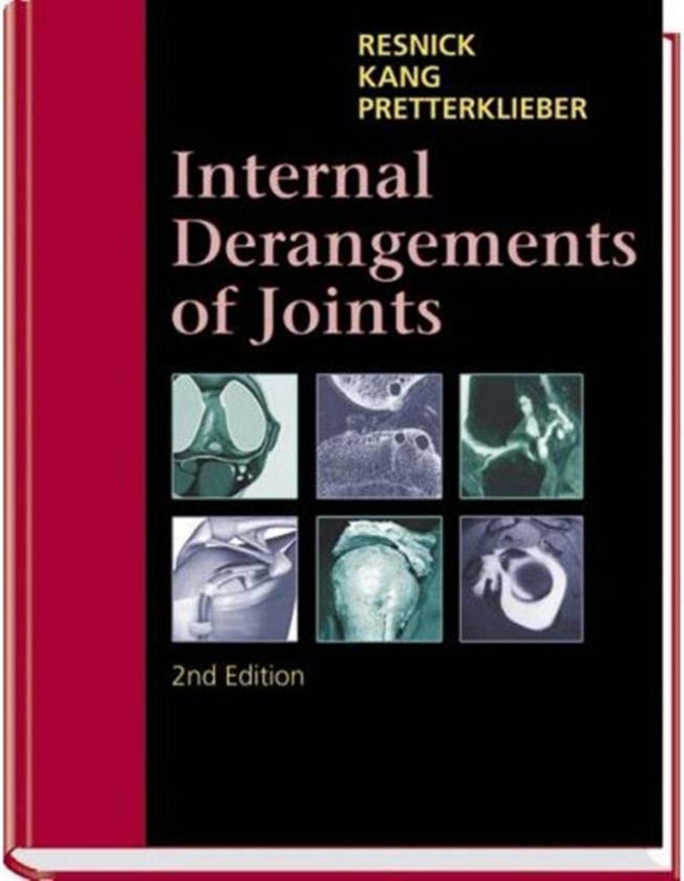 Internal Derangements of Joints by Donald L. Resnick Heung Sik Kang Michael L. Pretterklieber