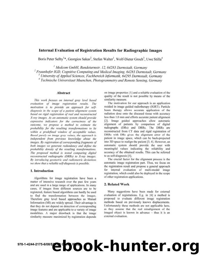Internal Evaluation of Registration Results for Radiograpbic Images by 