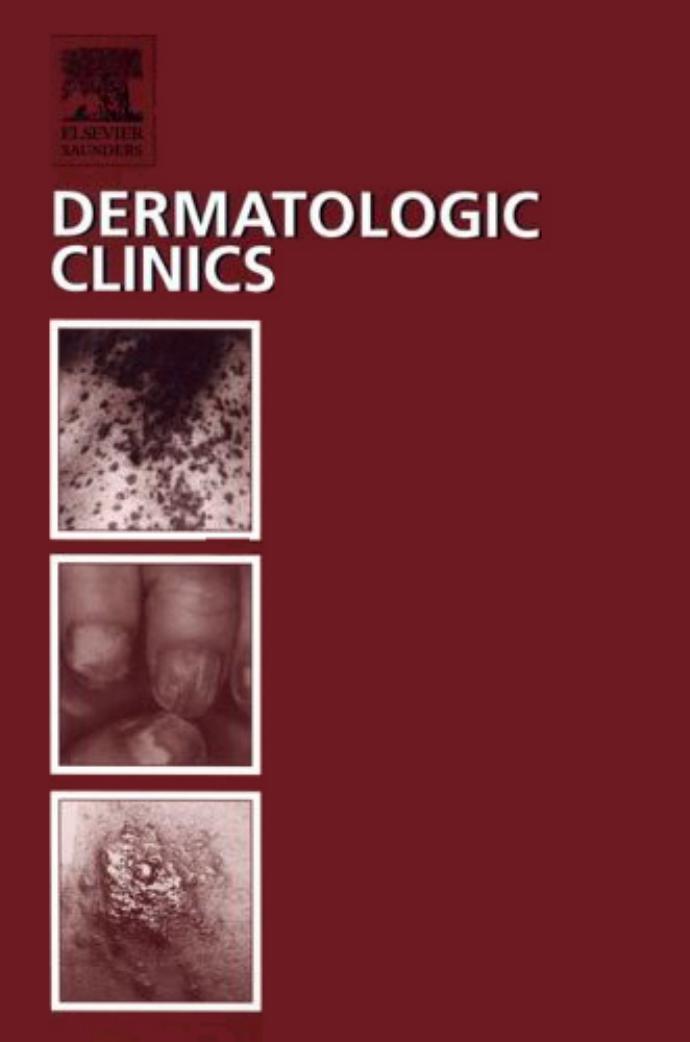 Internal Malignancy and The Skin: Paraneoplastic and Cancer Treatment-Related Cutaneous Disorders, An Issue of Dermatologic Clinics by Valencia Thomas Charles R. Thomas Jr. MD