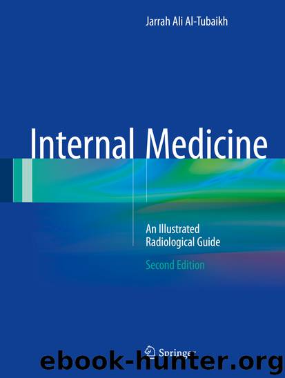 Internal Medicine by Jarrah Ali Al-Tubaikh