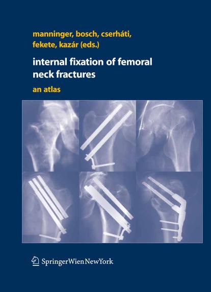 Internal fixation of femoral neck fractures An Atlas by Jenó Manninger Ulrich Bosch Peter Cserháti Károly Fekete György Kazár