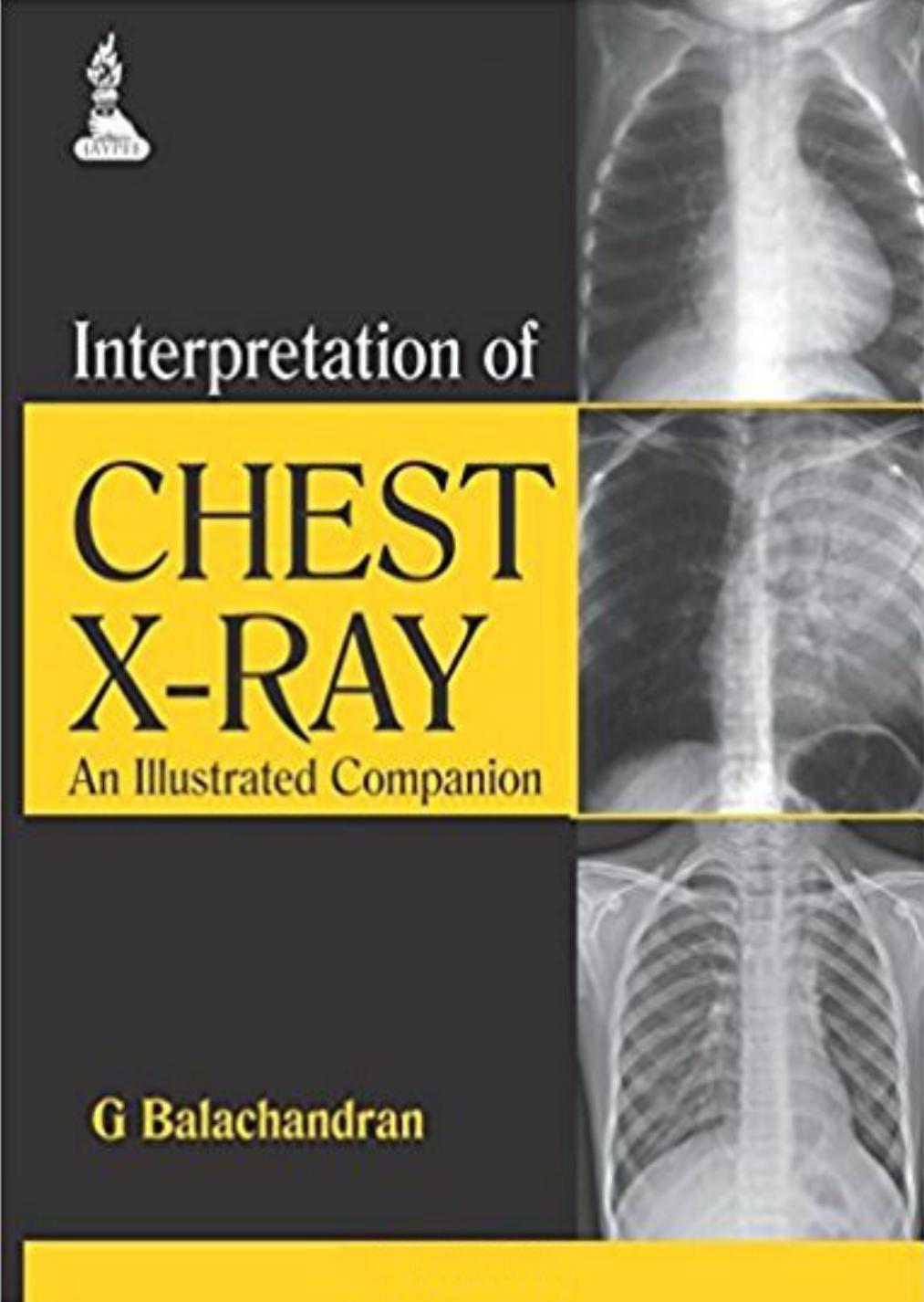 Interpretation of Chest X-Ray: An Illustrated Companion by G. Balachandran