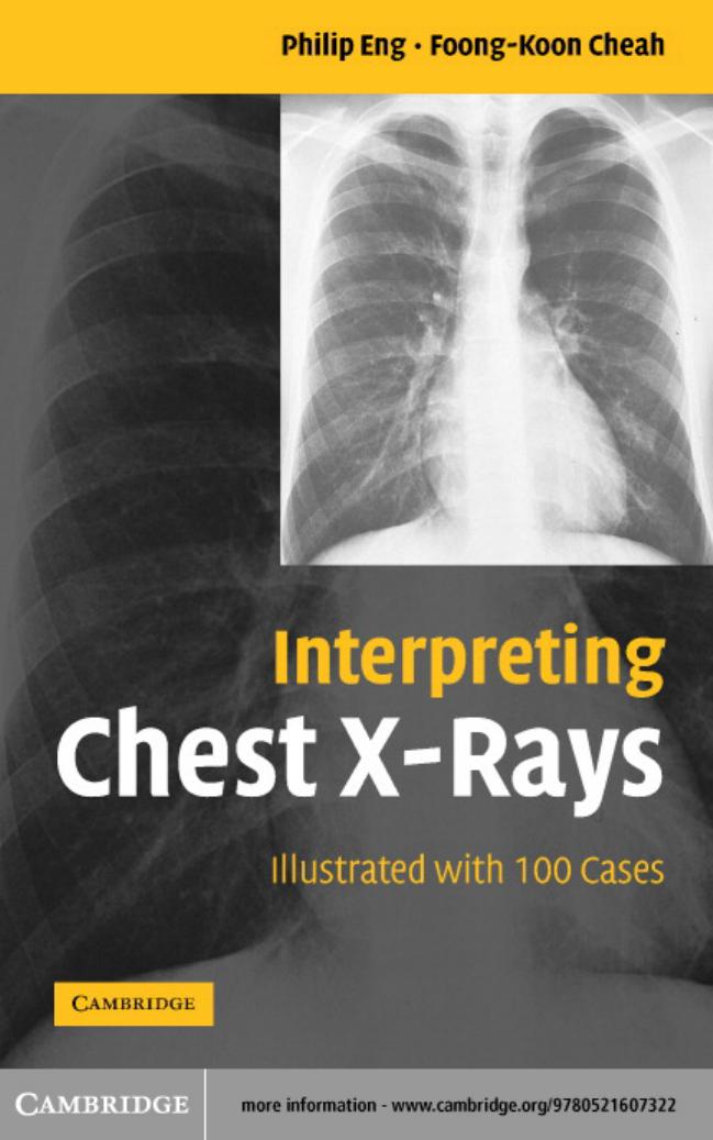 Interpreting Chest X-Rays Illustrated with 100 Cases by Philip Eng Foong-Koon Cheah