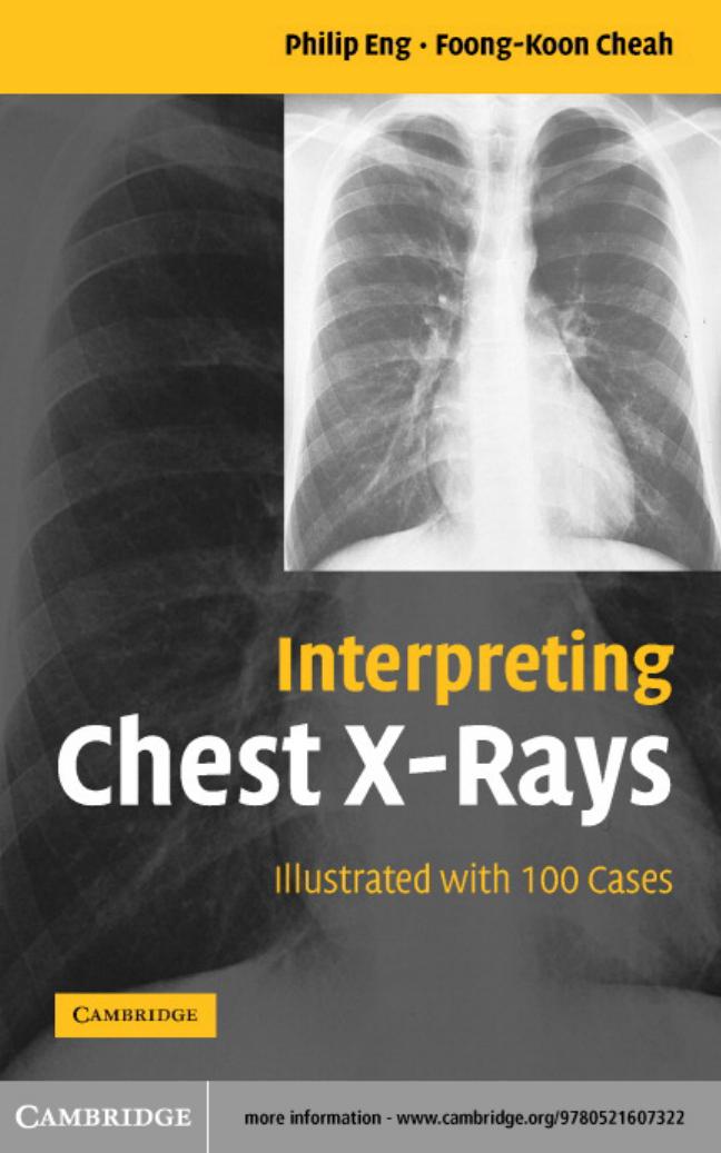 Interpreting Chest X-Rays: Illustrated with 100 Cases by Philip Eng Foong-Koon Cheah