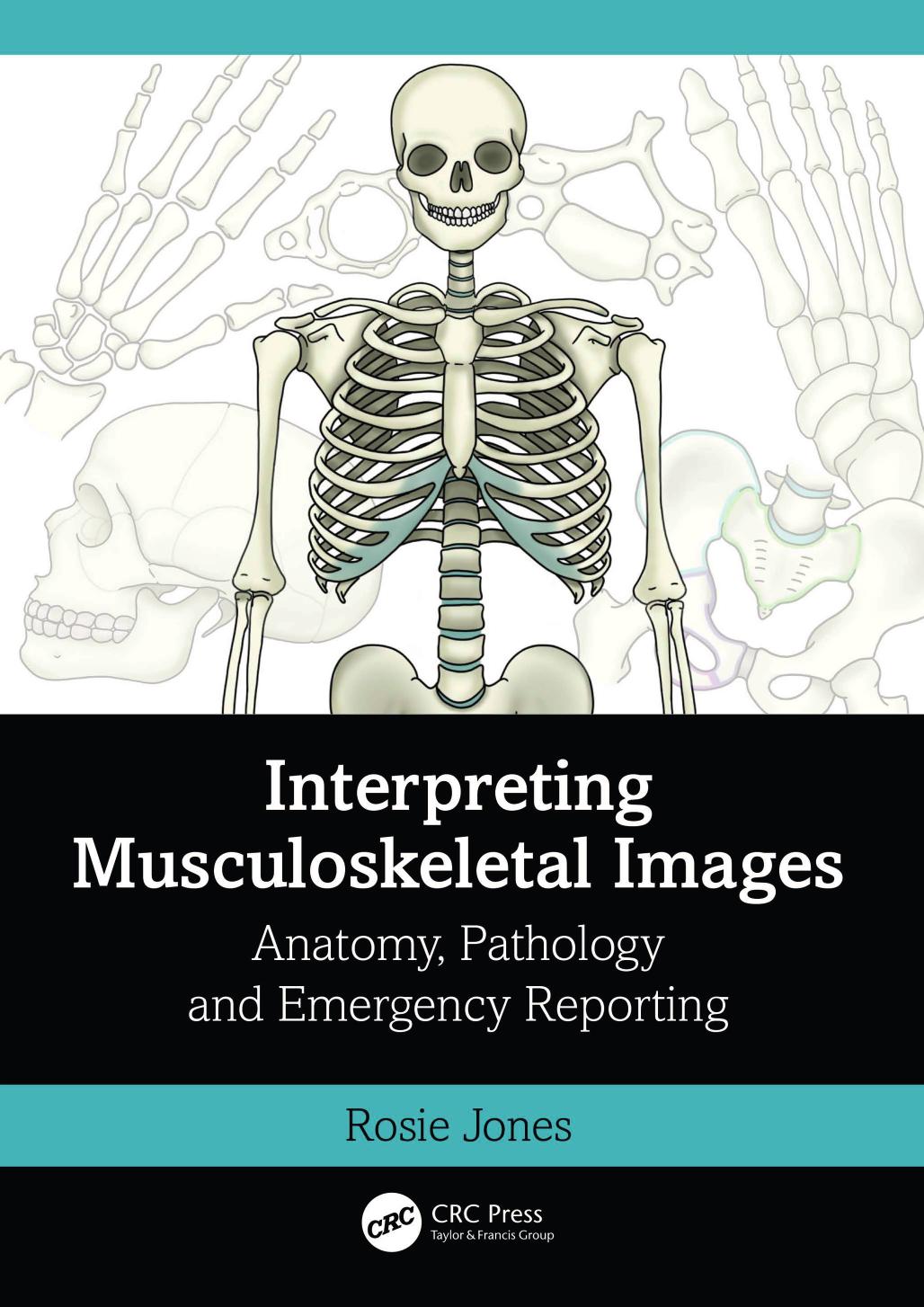 Interpreting Musculoskeletal Images: Anatomy, Pathology and Emergency Reporting by Rosie Jones