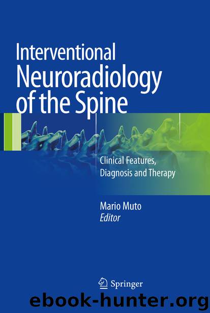 Interventional Neuroradiology of the Spine by Mario Muto