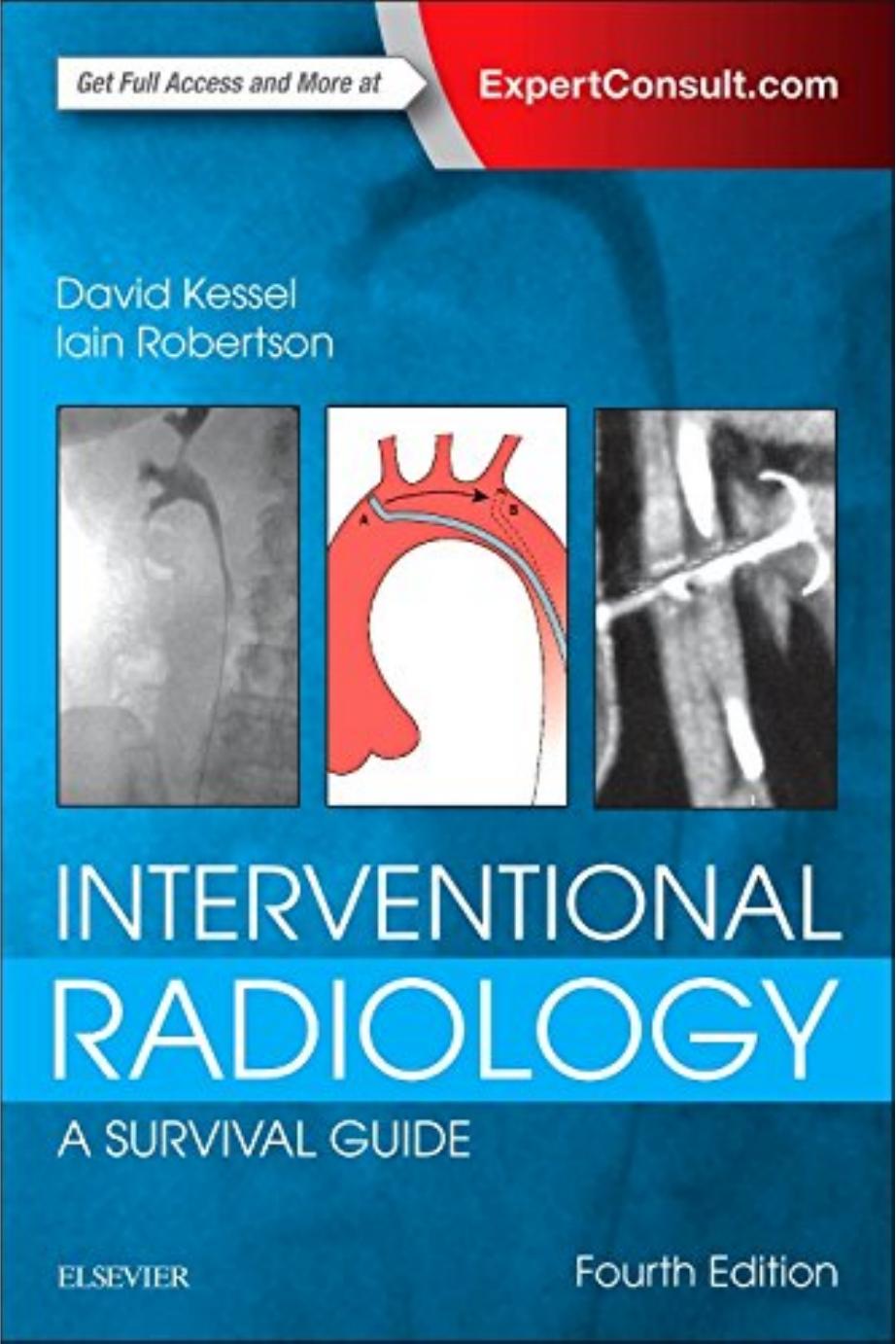 Interventional Radiology: A Survival Guide by David Kessel Iain Robertson