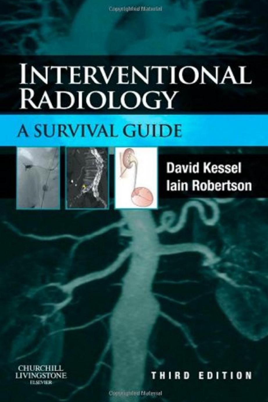 Interventional Radiology: A Survival Guide by David Kessel