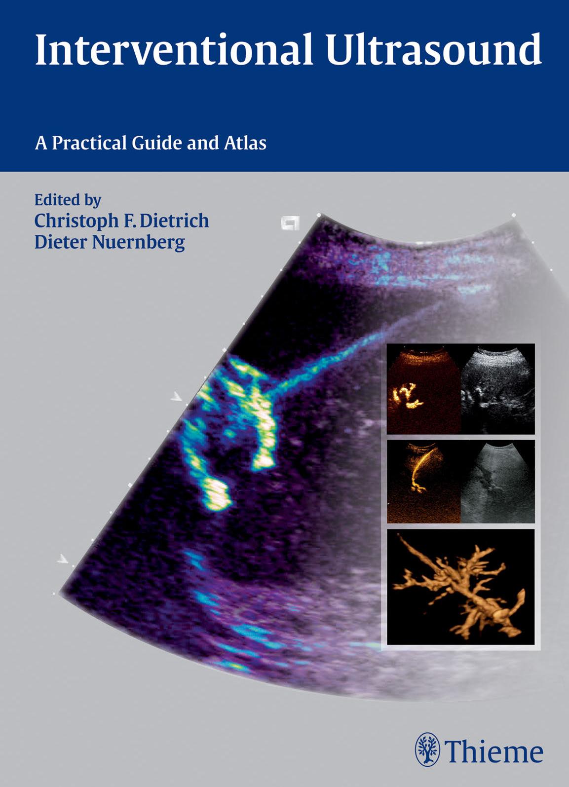 Interventional Ultrasound: A Practical Guide and Atlas by Christoph Frank Dietrich