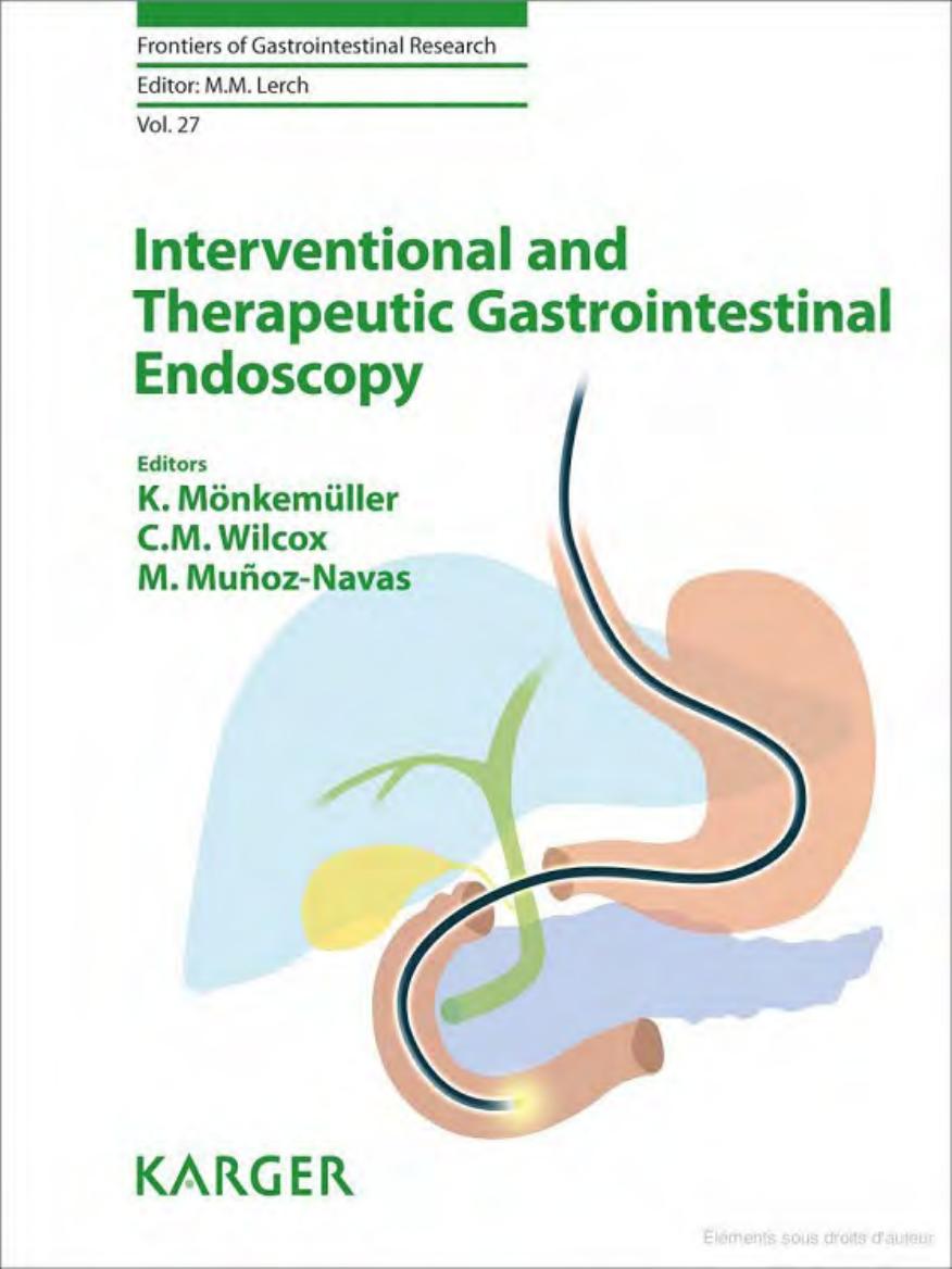 Interventional and Therapeutic Gastrointestinal Endoscopy by Klaus Monkemuller C. Mel Wilcox and Miguel Munoz-navas