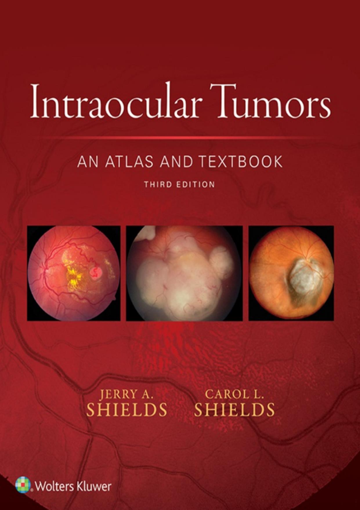Intraocular Tumors: An Atlas and Textbook by Dr. Jerry A. Shields Dr. Carol L. Shields