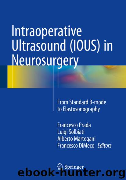 Intraoperative Ultrasound (IOUS) in Neurosurgery by Francesco Prada Luigi Solbiati Alberto Martegani & Francesco DiMeco
