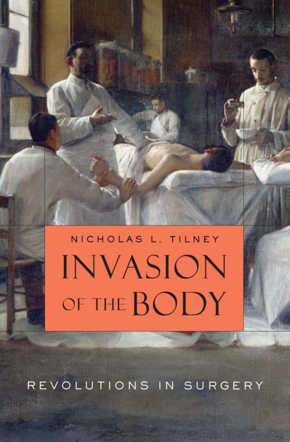 Invasion of the Body: Revolutions in Surgery by Nicholas L. Tilney