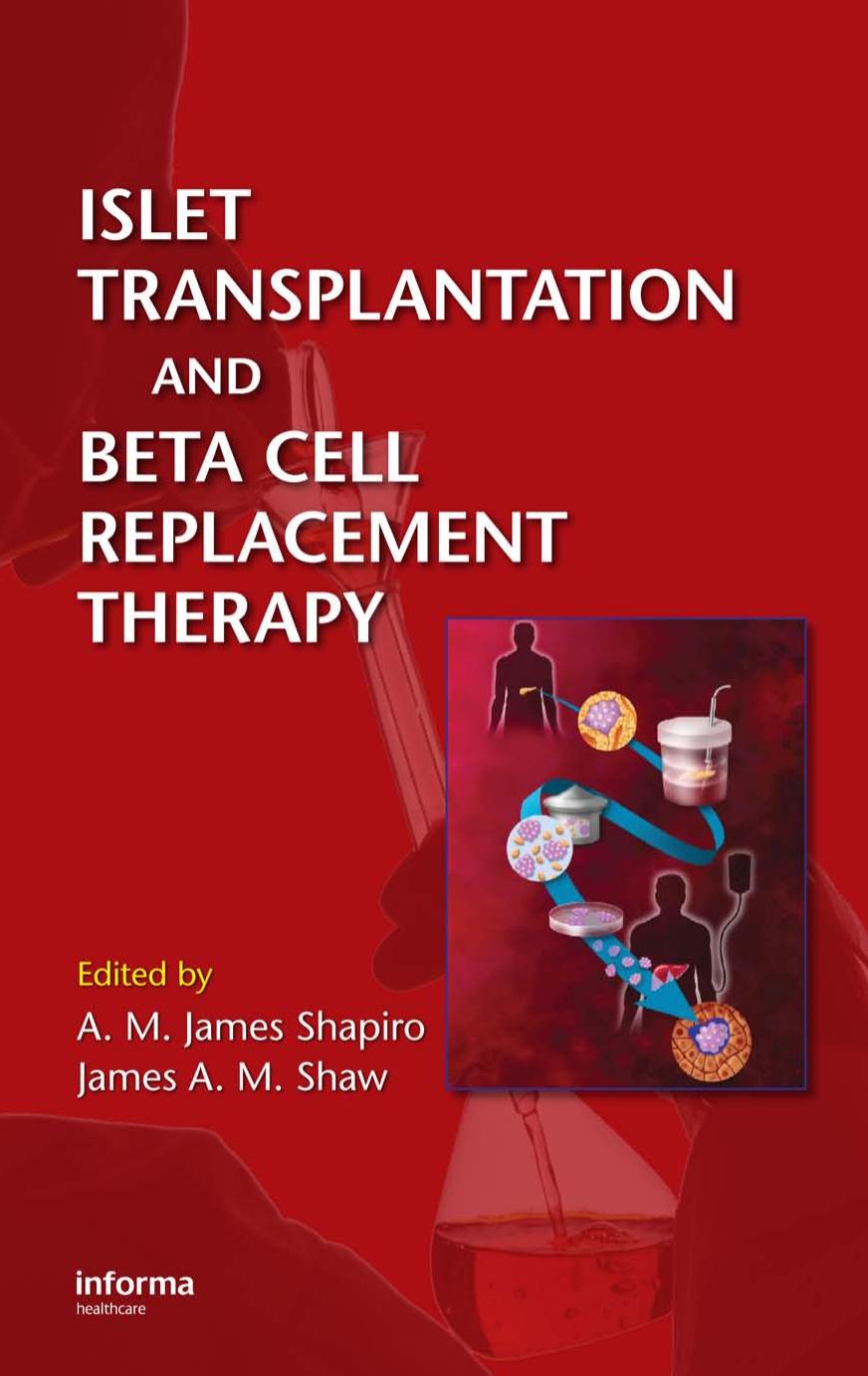 Islet Transplantation and Beta Cell Replacement Therapy by A.M. James Shapiro James A.M. Shaw