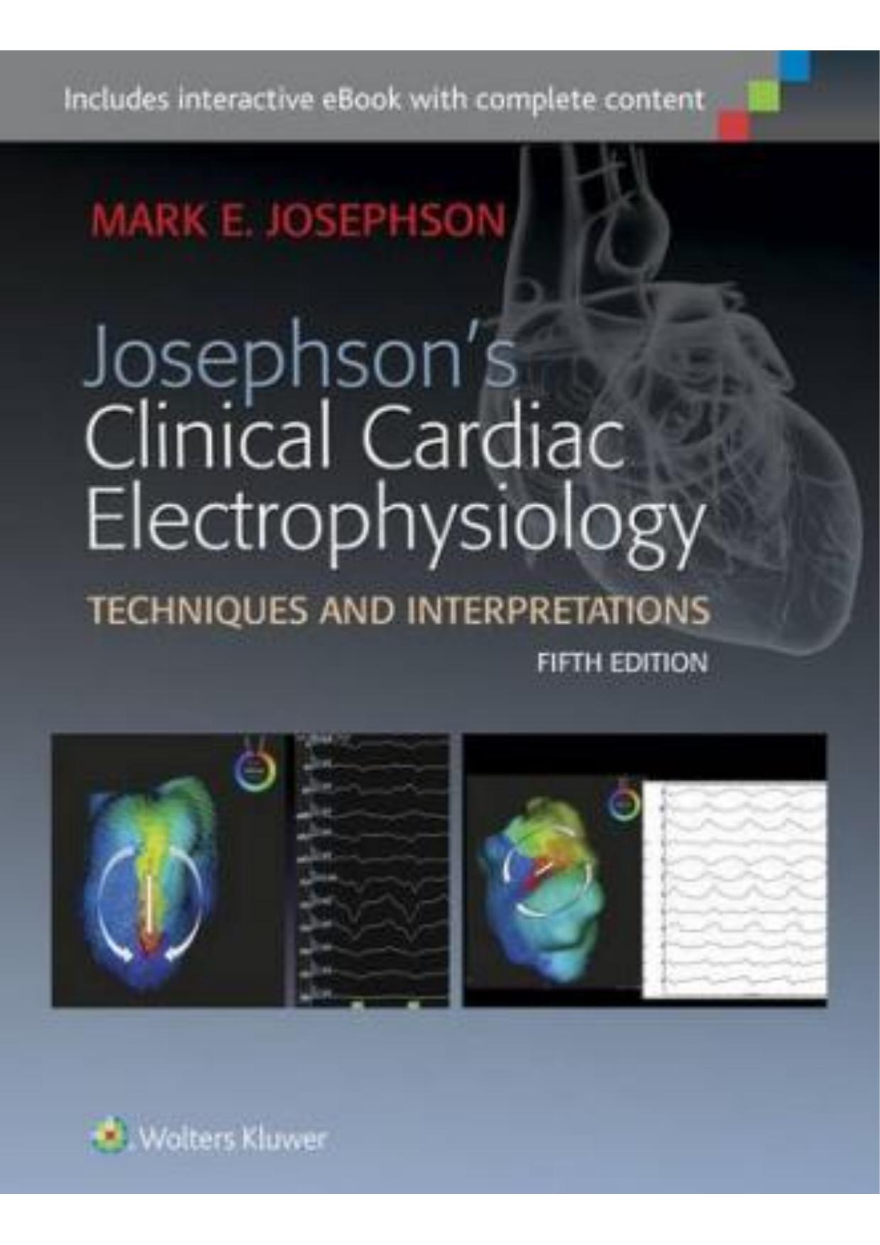 Josephson's Clinical Cardiac Electrophysiology Techniques and Interpretations [5 ed.] by Unknown