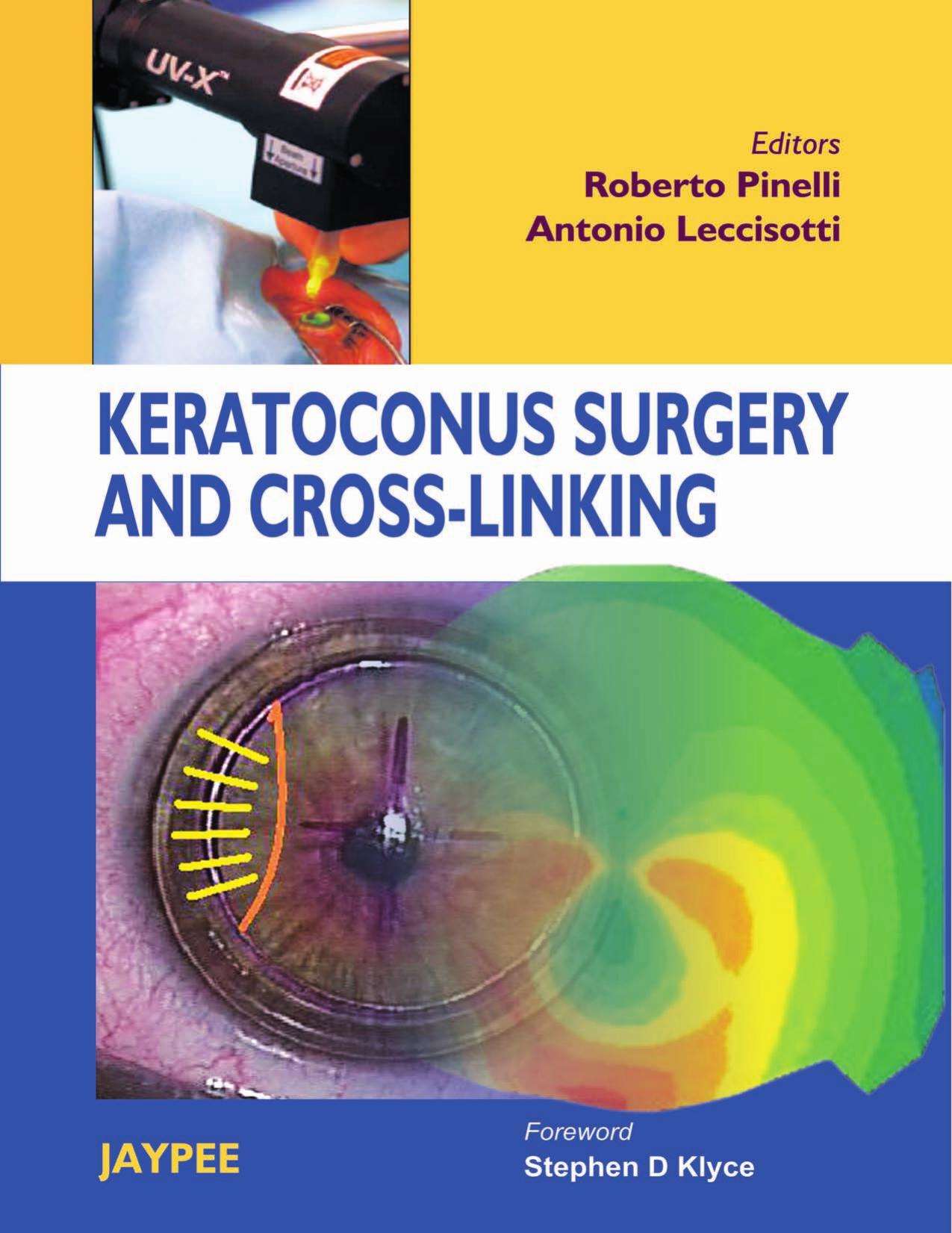 Keratoconus Surgery and Cross-linking by Roberto Pinelli Antonio Leccisotti