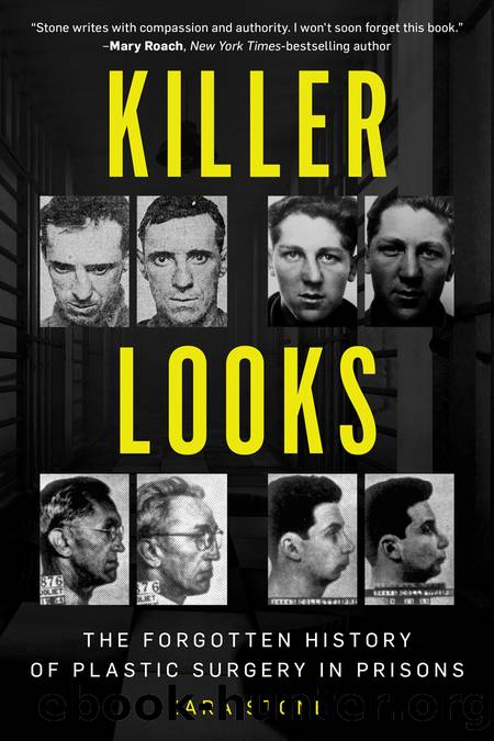 Killer Looks: The Forgotten History of Plastic Surgery in Prisons by Zara Stone