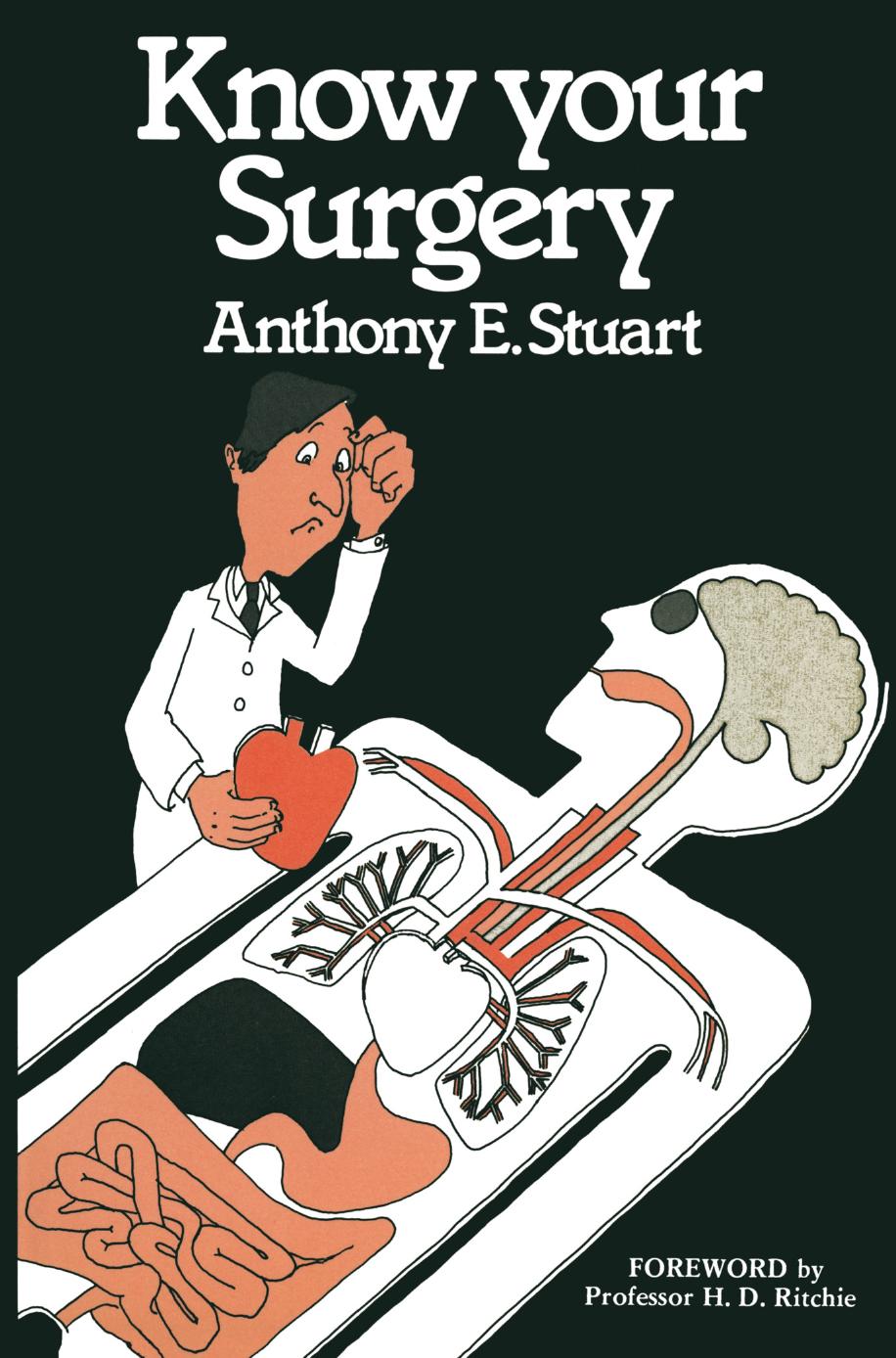 Know Your Surgery by Anthony E. Stuart (auth.)