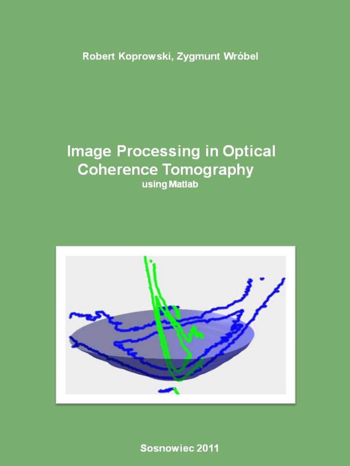Koprowski R., Wrobel Z. Image Processing in Optical Coherence Tomography (University of Silesia, 2011)(ISBN 8362462025)(en)(176s) by oem