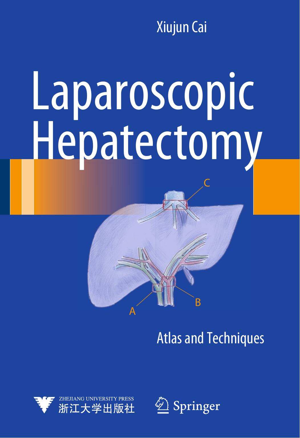 Laparoscopic Hepatectomy: Atlas and Techniques by Xiujun Cai (auth.)
