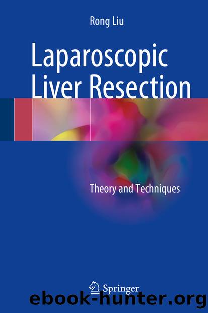 Laparoscopic Liver Resection by Rong Liu