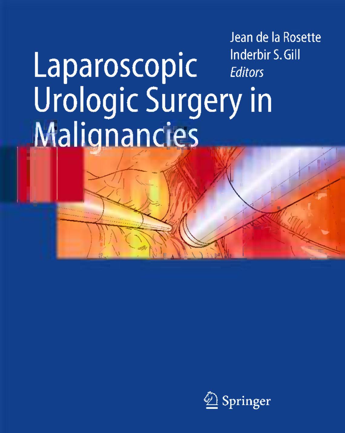 Laparoscopic Urologic Surgery in Malignancies by unknow