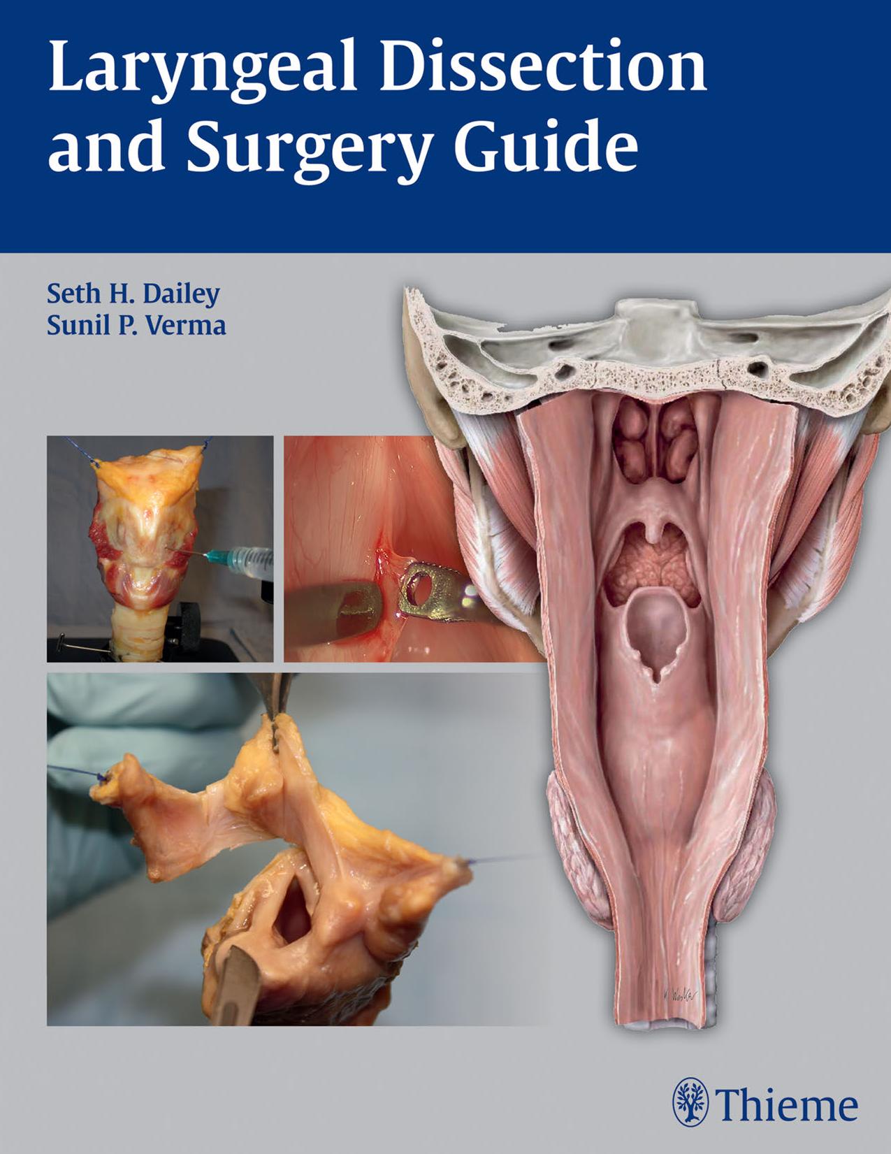 Laryngeal Dissection and Surgery Guide by Dailey Seth H.; Verma Sunil P